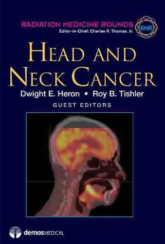 Cover image for Head and Neck Cancer