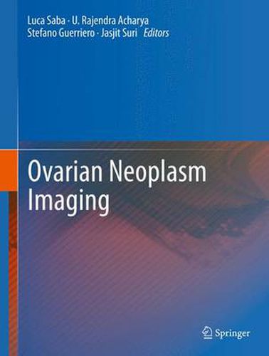 Cover image for Ovarian Neoplasm Imaging