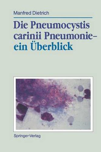Cover image for Die Pneumocystis Carinii Pneumonie- ein Uberblick