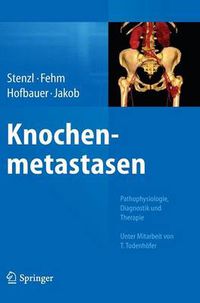 Cover image for Knochenmetastasen: Pathophysiologie, Diagnostik Und Therapie - Unter Mitarbeit Von T. Todenhoefer