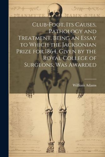 Cover image for Club-foot, its Causes, Pathology and Treatment, Being an Essay to Which the Jacksonian Prize for 1864, Given by the Royal College of Surgeons, was Awarded