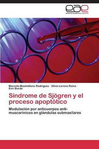 Cover image for Sindrome de Sjogren y El Proceso Apoptotico