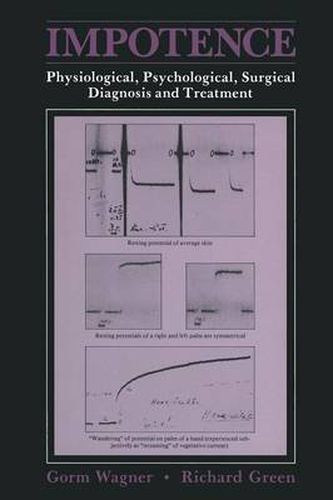 Cover image for Impotence: Physiological, Psychological, Surgical Diagnosis and Treatment