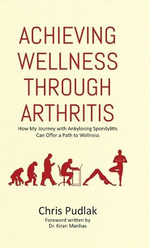 Cover image for Achieving Wellness Through Arthritis: How My Journey with Ankylosing Spondylitis Can Offer a Path to Wellness