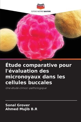 Cover image for Etude comparative pour l'evaluation des micronoyaux dans les cellules buccales