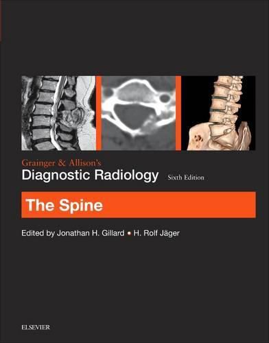 Cover image for Grainger & Allison's Diagnostic Radiology: The Spine