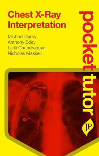 Cover image for Pocket Tutor Chest X-Ray Interpretation