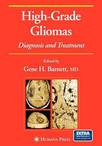 Cover image for High-Grade Gliomas: Diagnosis and Treatment