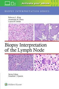 Cover image for Biopsy Interpretation of the Lymph Nodes