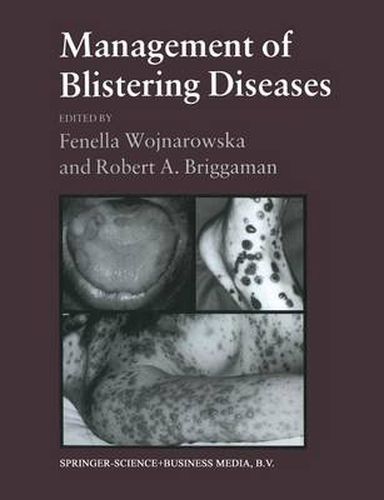 Cover image for Management of Blistering Diseases