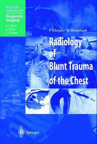 Cover image for Radiology of Blunt Trauma of the Chest