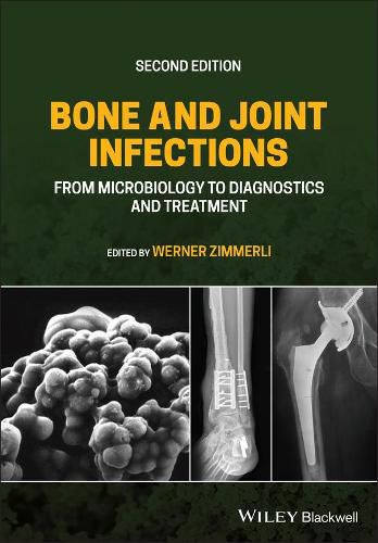 Cover image for Bone and Joint Infections - From Microbiology to Diagnostics and Treatment, Second Edition