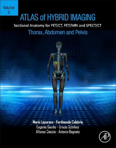 Cover image for Atlas of Hybrid Imaging of the Thorax, Abdomen and Pelvis, Volume 2: Sectional Anatomy for PET/CT, PET/MRI and SPECT/CT