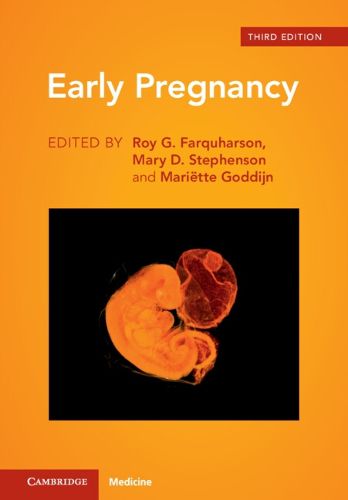 Cover image for Early Pregnancy