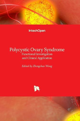 Cover image for Polycystic Ovary Syndrome