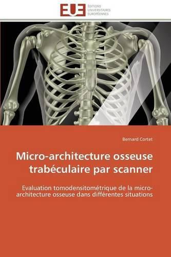 Micro-Architecture Osseuse Trab culaire Par Scanner