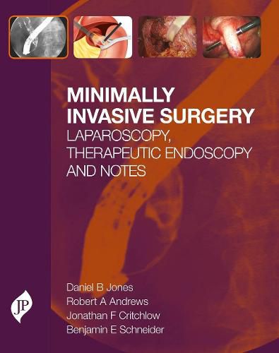 Minimally Invasive Surgery: Laparoscopy, Therapeutic Endoscopy and NOTES