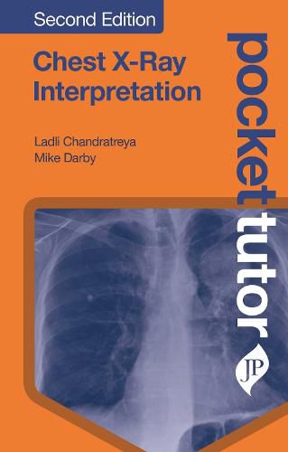 Cover image for Pocket Tutor Chest X-Ray Interpretation: Second Edition