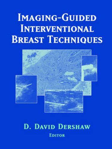 Cover image for Imaging-Guided Interventional Breast Techniques