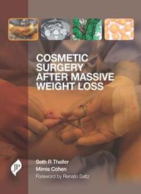 Cover image for Cosmetic Surgery after Massive Weight Loss