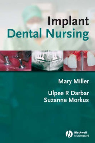 Cover image for Implant Dental Nursing