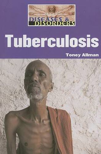 Cover image for Tuberculosis