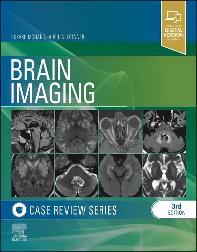 Cover image for Brain Imaging: Case Review Series, 3e