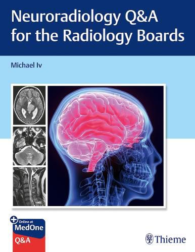 Cover image for Neuroradiology Q&A for the Radiology Boards