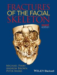 Cover image for Fractures of the Facial Skeleton