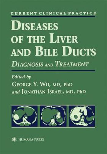 Cover image for Diseases of the Liver and Bile Ducts: A Practical Guide to Diagnosis and Treatment