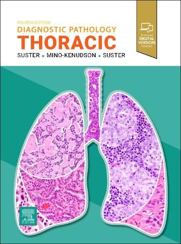 Cover image for Diagnostic Pathology: Thoracic