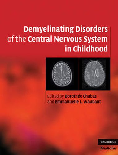 Demyelinating Disorders of the Central Nervous System in Childhood