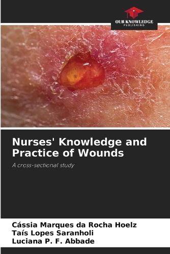 Cover image for Nurses' Knowledge and Practice of Wounds