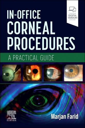 Cover image for In-Office Corneal Procedures