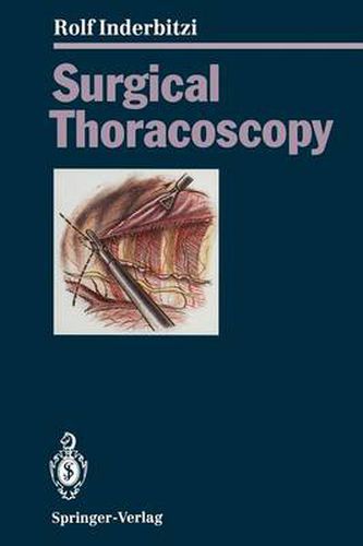 Cover image for Surgical Thoracoscopy