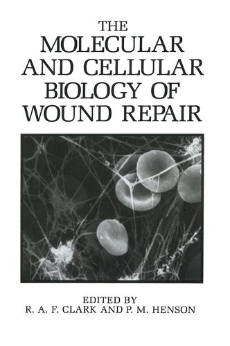 Cover image for The Molecular and Cellular Biology of Wound Repair