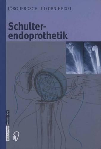 Cover image for Schulterendoprothetik: Indikation, Implantate, OP-Technik, Nachbehandlung, Begutachtung