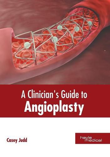Cover image for A Clinician's Guide to Angioplasty