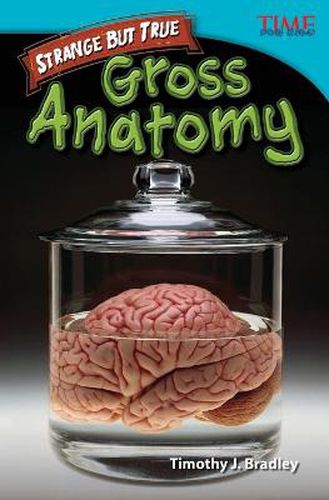 Cover image for Strange but True: Gross Anatomy