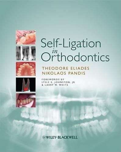 Cover image for Self-ligation in Orthodontics: An Evidence-based Approach to Biomechanics and Treatment