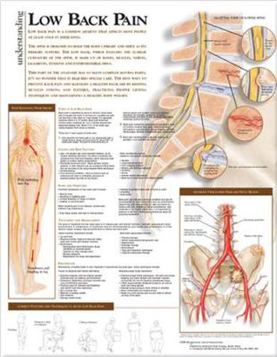 Cover image for Understanding Low Back Pain Anatomical Chart