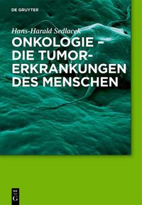 Cover image for Onkologie - die Tumorerkrankungen des Menschen