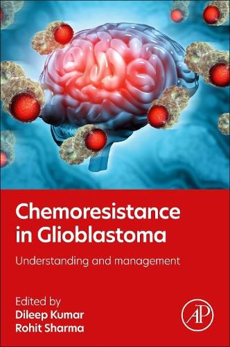 Cover image for Chemoresistance in Glioblastoma