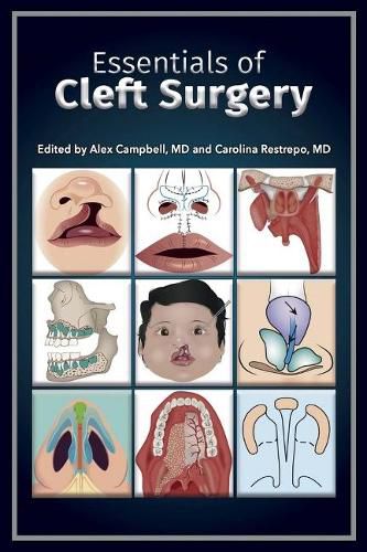 Cover image for Essentials of Cleft Surgery