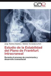 Cover image for Estudio de la Estabilidad del Plano de Frankfurt Intracraneal