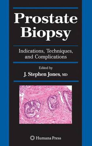 Cover image for Prostate Biopsy: Indications, Techniques, and Complications