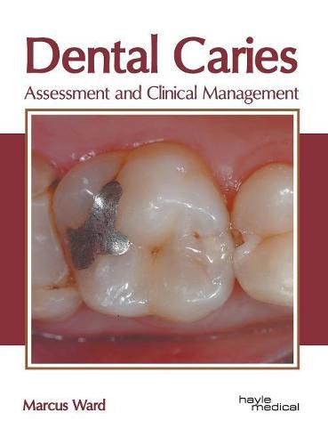 Cover image for Dental Caries: Assessment and Clinical Management