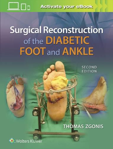 Cover image for Surgical Reconstruction of the Diabetic Foot and Ankle