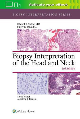 Cover image for Biopsy Interpretation of the Head and Neck