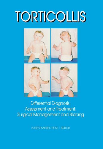 Cover image for Torticollis: Differential Diagnosis, Assessment and Treatment, Surgical Management and Bracing